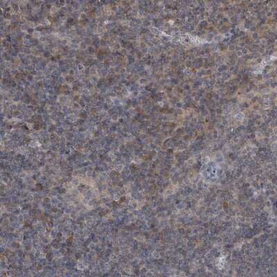 Immunohistochemistry-Paraffin: PROSC Antibody [NBP1-85991]