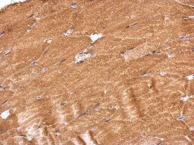 Immunohistochemistry-Paraffin: PROSC Antibody [NBP2-19948]