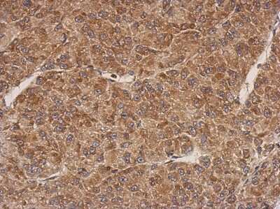 Immunohistochemistry-Paraffin: PROSC Antibody [NBP2-19948]