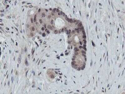 Immunohistochemistry: PROSC Antibody (OTI3G7) - Azide and BSA Free [NBP2-73622]