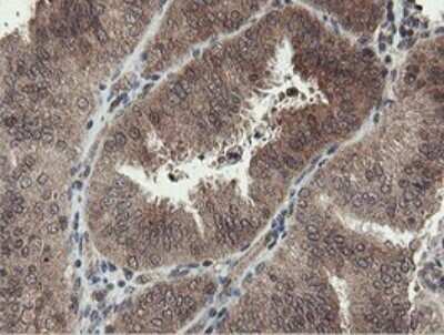 Immunohistochemistry: PROSC Antibody (OTI3G7) - Azide and BSA Free [NBP2-73622]
