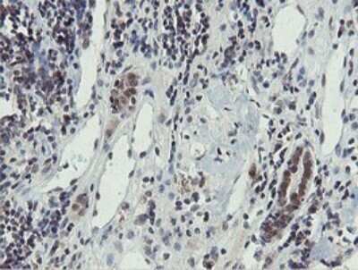 Immunohistochemistry: PROSC Antibody (OTI3G7) - Azide and BSA Free [NBP2-73622]