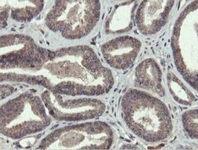 Immunohistochemistry: PROSC Antibody (OTI3G7) - Azide and BSA Free [NBP2-73622]