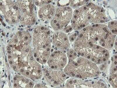 Immunohistochemistry: PROSC Antibody (OTI3G7) - Azide and BSA Free [NBP2-73622]