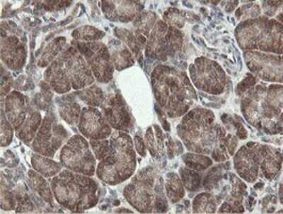 Immunohistochemistry: PROSC Antibody (OTI3G7) - Azide and BSA Free [NBP2-73622]