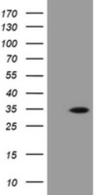 Western Blot: PROSC Antibody (OTI3G7)Azide and BSA Free [NBP2-73622]