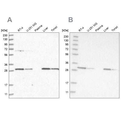 Western Blot: PROSC Antibody [NBP1-85989]