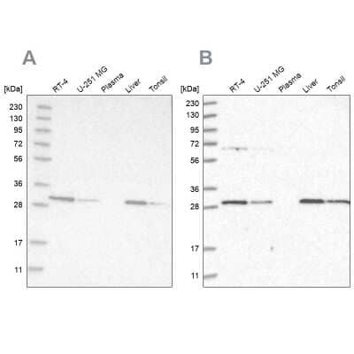 Western Blot: PROSC Antibody [NBP1-85991]