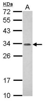 Western Blot: PROSC Antibody [NBP2-19948]