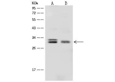 Western Blot: PROSC Antibody [NBP2-99607]