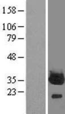 Western Blot: PROSC Overexpression Lysate [NBL1-14813]