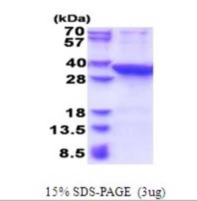 SDS-PAGE: Recombinant Human PROSC His Protein [NBP2-51644]