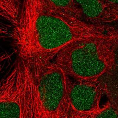 Immunocytochemistry/ Immunofluorescence: PROSER1 Antibody [NBP2-37949]