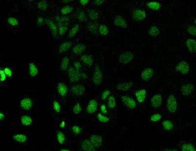 Immunocytochemistry/ Immunofluorescence: PROSER1 Antibody [NBP3-05784]