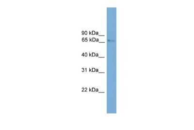 Western Blot: PROX2 Antibody [NBP2-83422]