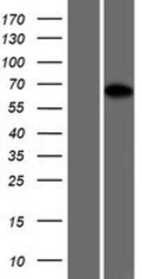 Western Blot: PROX2 Overexpression Lysate [NBP2-08487]