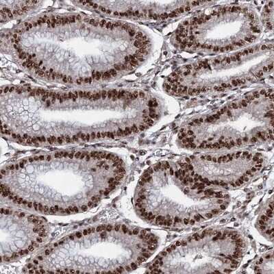 Immunohistochemistry-Paraffin: PRP18 Antibody [NBP1-92297]