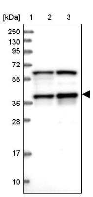 Western Blot: PRP18 Antibody [NBP1-92297]