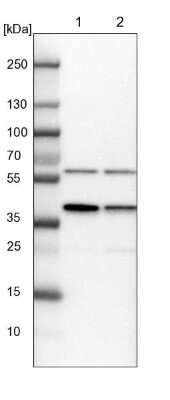 Western Blot: PRP18 Antibody [NBP1-92297]