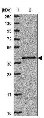 Western Blot: PRP18 Antibody [NBP2-46757]