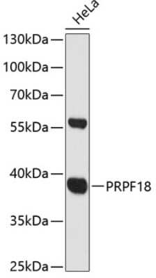 Western Blot: PRP18 AntibodyAzide and BSA Free [NBP2-93288]