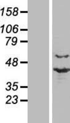 Western Blot: PRP18 Overexpression Lysate [NBL1-14816]