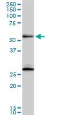Western Blot: PRP19 Antibody (2E5) [H00027339-M07]