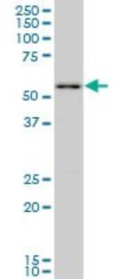 Western Blot: PRP19 Antibody (2E5) [H00027339-M07]