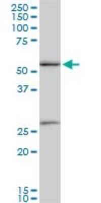 Western Blot: PRP19 Antibody (2E5) [H00027339-M07]