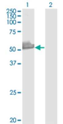 Western Blot: PRP19 Antibody (2E5) [H00027339-M07]