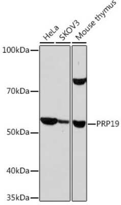 Western Blot: PRP19 Antibody (4M3Z1) [NBP3-16853]