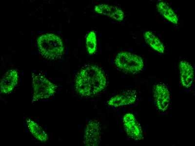 Immunocytochemistry/ Immunofluorescence: PRP19 Antibody [NBP2-99020]