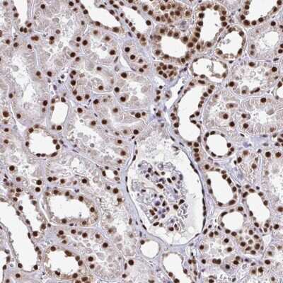 Immunohistochemistry: PRP19 Antibody [NBP2-38864]