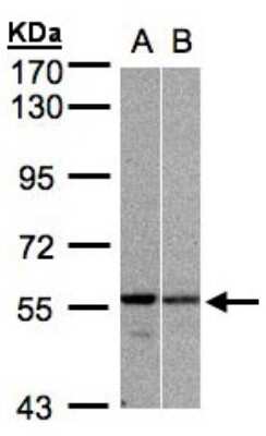 Western Blot: PRP19 Antibody [NBP1-31246]