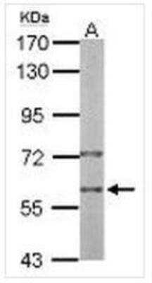 Western Blot: PRP19 Antibody [NBP1-31354]
