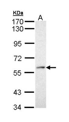 Western Blot: PRP19 Antibody [NBP1-33117]