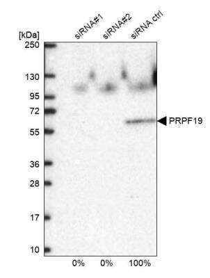 Western Blot: PRP19 Antibody [NBP2-38381]