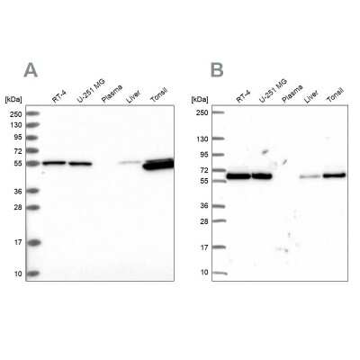 Western Blot: PRP19 Antibody [NBP2-38381]