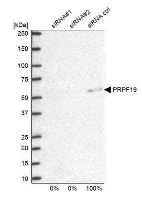 Western Blot: PRP19 Antibody [NBP2-38864]