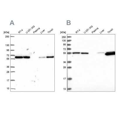 Western Blot: PRP19 Antibody [NBP2-38864]