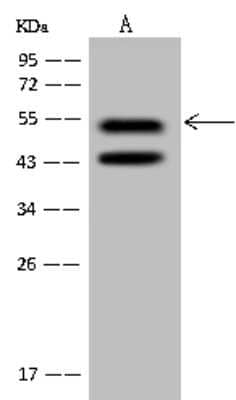 Western Blot: PRP19 Antibody [NBP2-98571]