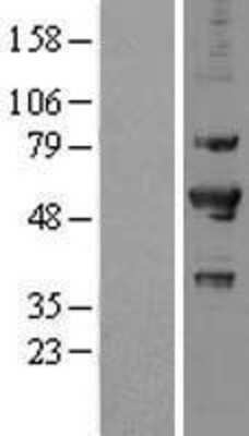 Western Blot: PRP19 Overexpression Lysate [NBL1-14817]