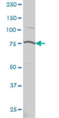 Western Blot: PRPF3 Antibody (3H6) [H00009129-M01]