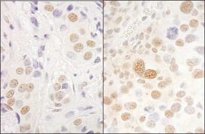Immunohistochemistry: PRPF3 Antibody [NBP1-19114]