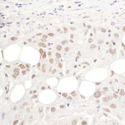 Immunohistochemistry-Paraffin: PRPF3 Antibody [NBP1-19114]