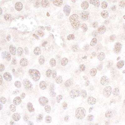 Immunohistochemistry-Paraffin: PRPF3 Antibody [NBP1-19114]