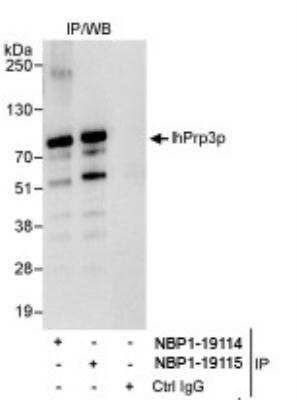 Immunoprecipitation: PRPF3 Antibody [NBP1-19114]
