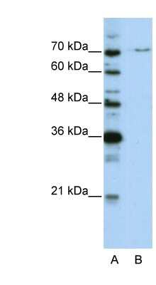 Western Blot: PRPF3 Antibody [NBP1-57201]