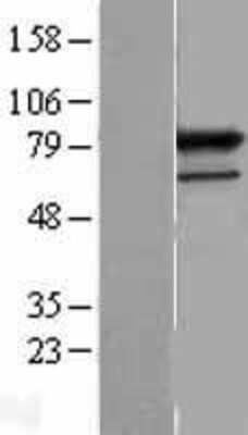 Western Blot: PRPF3 Overexpression Lysate [NBL1-14818]