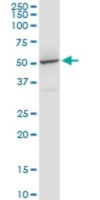 Western Blot: PRPF31 Antibody (8E1) [H00026121-M02]